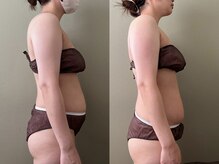 モモリラ(momorila)/セルクラ