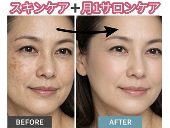 ヴィーナスハンドの写真/歴18年の凄腕オーナーがお肌もお体もお悩みを根本改善！整体師エステで、あらゆるお悩みに徹底アプローチ☆