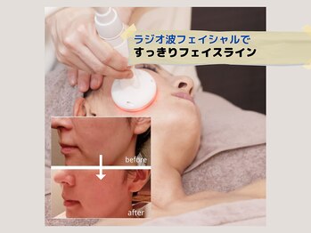 ラヴィアンローズの写真/即効性★1回でもフェイスラインの変化を実感！
自己流ケアでは届かない深部にアプローチできます◎