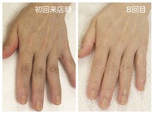 キレイテ 上野店/40代/8回目【ハンドケア稲荷町】
