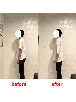 ナオル整体 福岡香椎院(NAORU整体)/20代男性施術事例【姿勢改善】