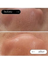 トータルビューティーサロンリア(Li'a)/ビフォー＆アフター