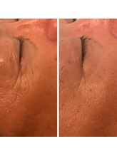 ジーニー(Genie)/ララピール始まってます