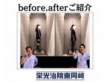 栄光治院 整体院東岡崎/頭痛そのままで辛くないですか？