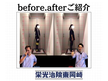 栄光治院 整体院東岡崎/頭痛そのままで辛くないですか？