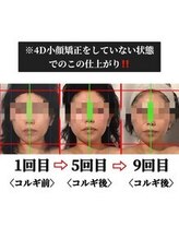 小顔整体研究所 KSラボ 新潟中山店/