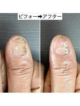 桃の木 吉祥寺店/隠さないで改善して行く爪ケア