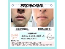 つるる(TWORURU)/当店は男性にも人気です♪