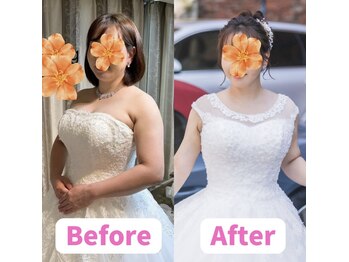 ボディキュア ブライダル美容整体 大阪梅田/ダイエットから1年後の後撮り