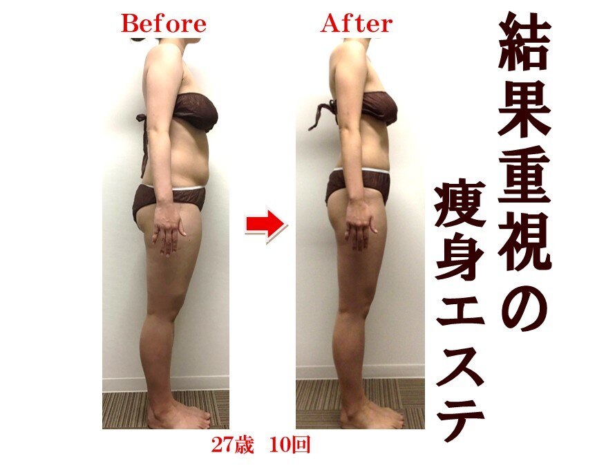ビモア(美more)｜ホットペッパービューティー
