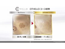 わたしの 大阪枚方本店/NOファンデーションも実現