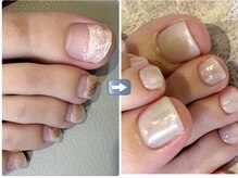 マロネ(Marone)の雰囲気(割れ爪・剥離も改善!育爪で理想の指先へ導くサロン♪)