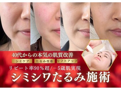 ヴィアス(VIAS)の写真