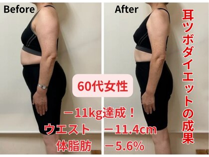 ア クイーユの写真