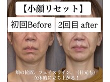 グラースア(grace a)の雰囲気（平面縦長にたるむ→骨格、表情筋、お肌から整えて、パッと美しく）