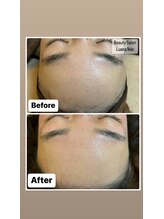 ルアナ ナオ(Luana Nao)/Wax脱毛で毛穴のつまりも改善！