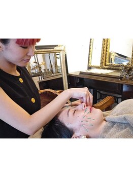 鍼灸施術を受けたい