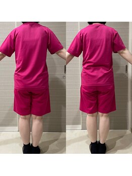 ギャラクシービューティー(galaxy beauty)/肩甲骨