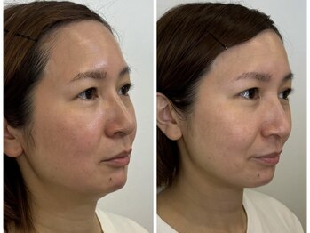 ドクターボディクリスタル(Dr.Body Crystal)/40代