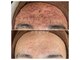 エムケーサロン(MK salon)の写真