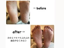 エム 平岸(M)