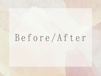 リッチョ鍼灸院(Riccio鍼灸院)/施術効果