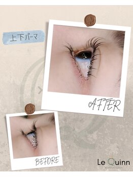 ルクイン 恵比寿 白金(Le Quinn)/Before&After《上下パーマ》