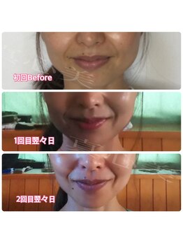 真心美/変化を育てる小顔矯正