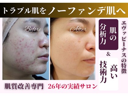 エヴァビーナス(EvaVenus)の写真