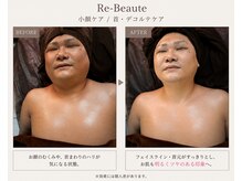 レヴォーテ 練馬(Re-Beaute)/オイルトリートメント