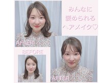 ウル 恵比寿渋谷店(ULU)/トータルコースのBefore&After