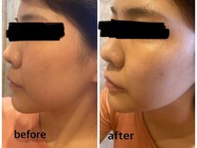 アルカディアジム(ARCADIA GYM)/フェイシャルエステ(20代女性)