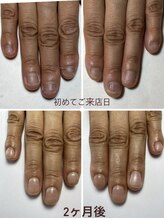 ネイルカフェ ナナ(nailcafe'nana)/自爪育成矯正