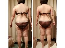 サクラス(SUQRAS)/ビフォーアフター/6回