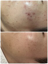 リノ(Lino)/20代30代！メンズ多数来店！