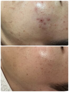 リノ(Lino)/20代30代!メンズ多数来店!