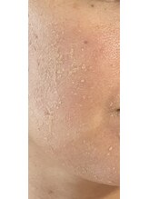 デイジー/グリーンピールのシェドの様子