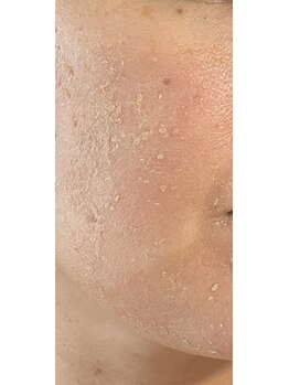 デイジー/グリーンピールのシェドの様子