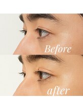 トップ ブロウ オム(TOP BROW HOMME)/上下まつパで目力アップ 天王寺