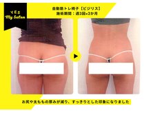 イエス マイサロン(yes My Salon)/自動筋トレマシンBIJIRIS施術例