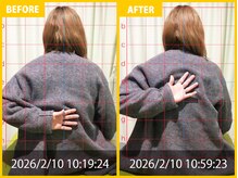 整体院 元 宇城松橋店/肩の痛みの悩み