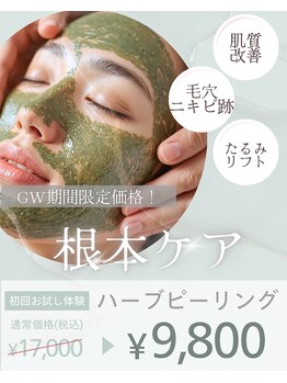 サロンドボーテアリス (Salon de beaute ALICE)の写真/【ニキビケアプログラム】ヴェルナハーブピーリング＋小顔筋膜リフト60分→¥9800たるみ・しみ・しわも改善