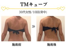 スパイア(SPIRE)/TMキューブ