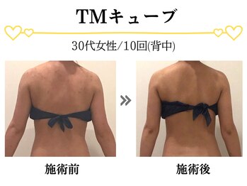 スパイア(SPIRE)/TMキューブ