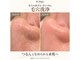 ビーマジック(Be Magic)の写真
