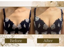 マリン(MARINE)/Before→After