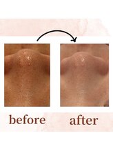 エルブラン(Aile-blanc)/毛穴/小顔/肩こり/フェイシャル 