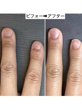 桃の木 吉祥寺店/ネイルケアで印象UP！