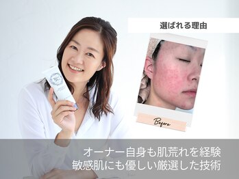 ビューティー ブロッサム(Beauty Blossom)/