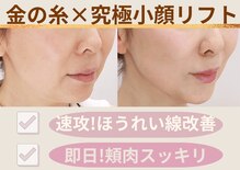 ムーンライズ(moonrise)